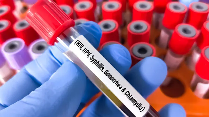 Giornata mondiale della salute sessuale: in Italia stabile l’Hiv ma crescono le altre infezioni